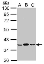 Anti-Pyruvate Dehydrogenase E1 beta subunit antibody used in Western Blot (WB). GTX104040