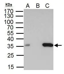 Anti-BRAF35 antibody used in Immunoprecipitation (IP). GTX104102