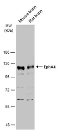 Anti-EphA4 antibody [N3C2], Internal used in Western Blot (WB). GTX104109