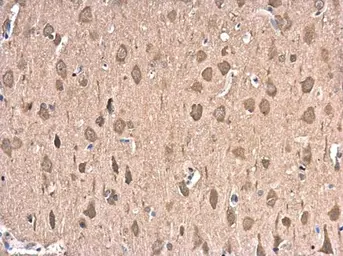 Anti-Hsp70 antibody used in IHC (Paraffin sections) (IHC-P). GTX104126