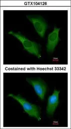 Anti-Hsp70 antibody used in Immunocytochemistry/ Immunofluorescence (ICC/IF). GTX104126