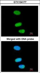 Anti-SOX13 antibody [N1C3] used in Immunocytochemistry/ Immunofluorescence (ICC/IF). GTX104177