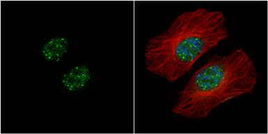 Anti-HMBOX1 antibody [N3C3] used in Immunocytochemistry/ Immunofluorescence (ICC/IF). GTX104189
