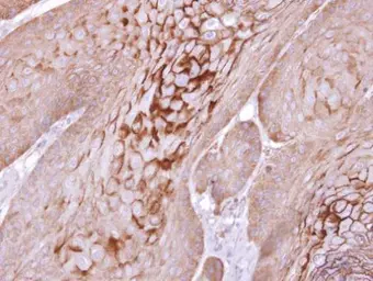 Anti-Kallikrein 11 antibody [N1C3] used in IHC (Paraffin sections) (IHC-P). GTX104200