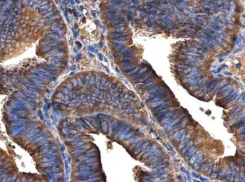 Anti-ARFIP2 antibody [N1C2] used in IHC (Paraffin sections) (IHC-P). GTX104241