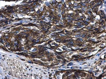 Anti-ARFIP2 antibody [N1C2] used in IHC (Paraffin sections) (IHC-P). GTX104241