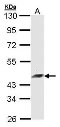 Anti-ARFIP2 antibody [N1C2] used in Western Blot (WB). GTX104241
