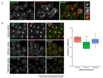 Anti-GOLGA5 antibody [N2C2], Internal used in Immunocytochemistry/ Immunofluorescence (ICC/IF). GTX104255