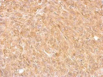 Anti-AKR7A2 antibody used in IHC (Paraffin sections) (IHC-P). GTX104299