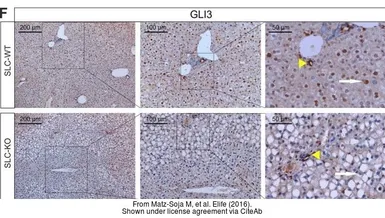 Anti-GLI3 antibody used in IHC (Paraffin sections) (IHC-P). GTX104362