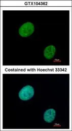 Anti-GLI3 antibody used in Immunocytochemistry/ Immunofluorescence (ICC/IF). GTX104362