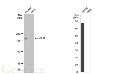 Anti-GLI3 antibody used in Western Blot (WB). GTX104362
