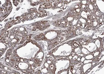 Anti-Adenylate kinase 4 antibody [N1C3] used in IHC (Paraffin sections) (IHC-P). GTX104430