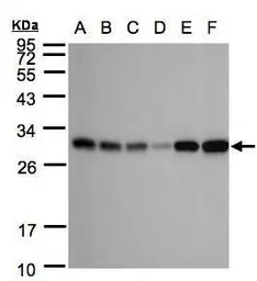Anti-Adenylate kinase 4 antibody [N1C3] used in Western Blot (WB). GTX104430