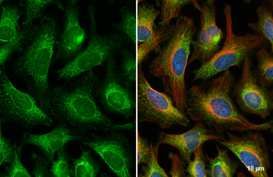 Anti-BCKDK antibody [N2C3] used in Immunocytochemistry/ Immunofluorescence (ICC/IF). GTX104477