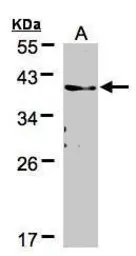Anti-TMEM59 antibody used in Western Blot (WB). GTX104486