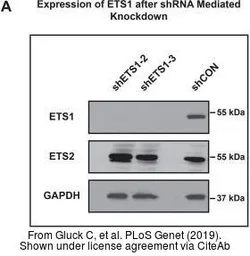 Anti-ETS2 antibody used in Western Blot (WB). GTX104527