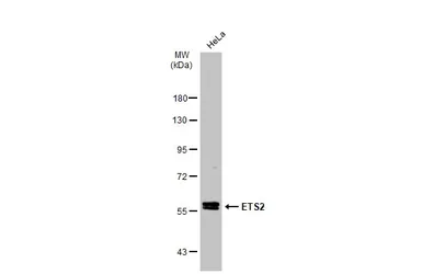 Anti-ETS2 antibody used in Western Blot (WB). GTX104527