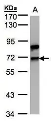 Anti-Splicing factor 1 antibody [N1N3] used in Western Blot (WB). GTX104540