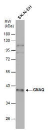 Anti-GNAQ antibody used in Western Blot (WB). GTX104544