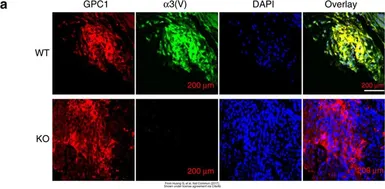 Anti-Glypican 1 antibody [N3C3] used in IHC (Paraffin sections) (IHC-P). GTX104557