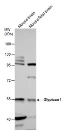 Anti-Glypican 1 antibody [N3C3] used in Western Blot (WB). GTX104557