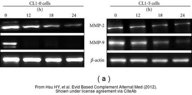 Anti-MMP2 antibody used in Western Blot (WB). GTX104577