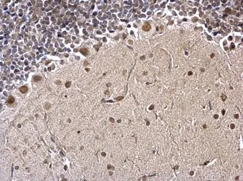 Anti-FUBP1 antibody used in IHC (Paraffin sections) (IHC-P). GTX104579