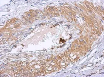 Anti-Dystrobrevin beta antibody used in IHC (Paraffin sections) (IHC-P). GTX104584
