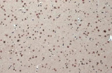 Anti-CSB antibody [N2C1], Internal used in IHC (Paraffin sections) (IHC-P). GTX104589