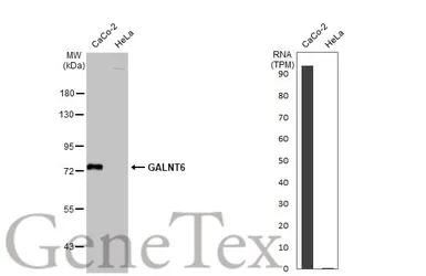Anti-GALNT6 antibody [N1C2] used in Western Blot (WB). GTX104602