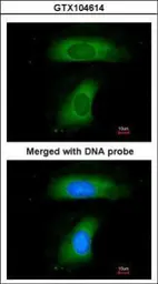 Anti-BLNK antibody [C3], C-term used in Immunocytochemistry/ Immunofluorescence (ICC/IF). GTX104614