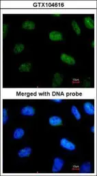 Anti-STAT3 antibody [C3], C-term used in Immunocytochemistry/ Immunofluorescence (ICC/IF). GTX104616
