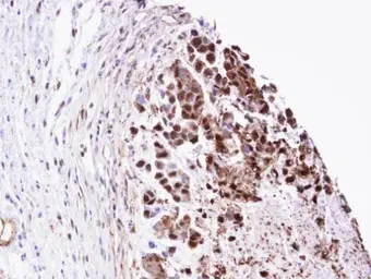Anti-Triosephosphate isomerase antibody [C2C3], C-term used in IHC (Paraffin sections) (IHC-P). GTX104618