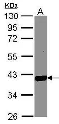 Anti-AKR1C3 antibody [C2C3], C-term used in Western Blot (WB). GTX104627