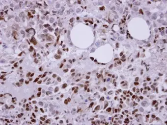Anti-Laforin antibody [C2C3], C-term used in IHC (Paraffin sections) (IHC-P). GTX104648