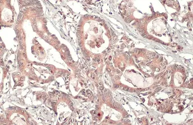 Anti-MMP7 antibody [C2C3], C-term used in IHC (Paraffin sections) (IHC-P). GTX104658