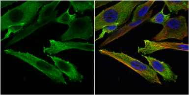 Anti-Stathmin 1 antibody used in Immunocytochemistry/ Immunofluorescence (ICC/IF). GTX104707