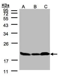 Anti-Stathmin 1 antibody used in Western Blot (WB). GTX104707