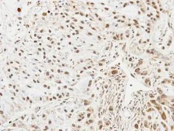 Anti-UBE2L3 antibody used in IHC (Paraffin sections) (IHC-P). GTX104717
