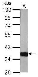 Anti-ARPC1A antibody [N1], N-term used in Western Blot (WB). GTX104743