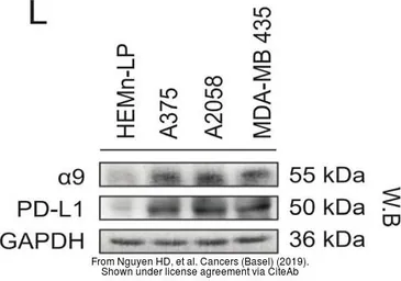 Anti-PD-L1 antibody used in Western Blot (WB). GTX104763