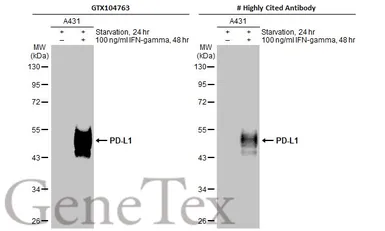 Anti-PD-L1 antibody used in Western Blot (WB). GTX104763