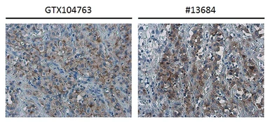 Anti-PD-L1 antibody used in IHC (Paraffin sections) (IHC-P). GTX104763