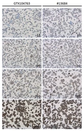 Anti-PD-L1 antibody used in IHC (Paraffin sections) (IHC-P). GTX104763