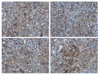 Anti-PD-L1 antibody used in IHC (Paraffin sections) (IHC-P). GTX104763