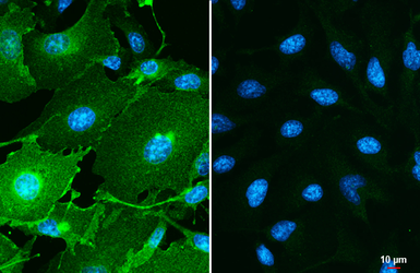 Anti-PD-L1 antibody used in Immunocytochemistry/ Immunofluorescence (ICC/IF). GTX104763