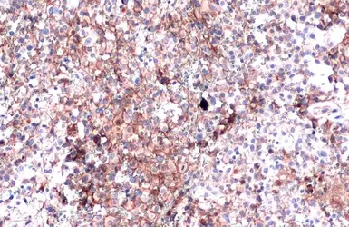 Anti-PD-L1 antibody used in IHC (Paraffin sections) (IHC-P). GTX104763