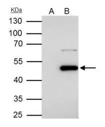 Anti-Flotillin 1 antibody [C3], C-term used in Immunoprecipitation (IP). GTX104769