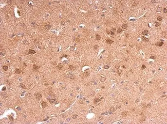 Anti-Adiponectin Receptor 1 antibody [C2C3], C-term used in IHC (Paraffin sections) (IHC-P). GTX104770